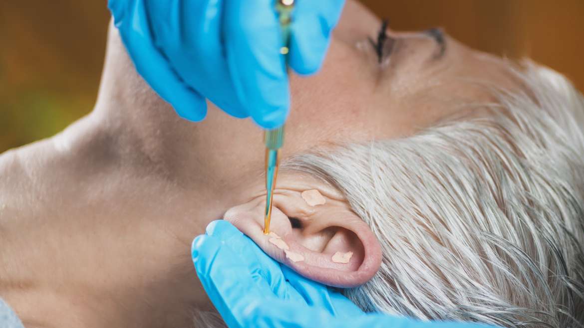 Acupuntura para Empresas